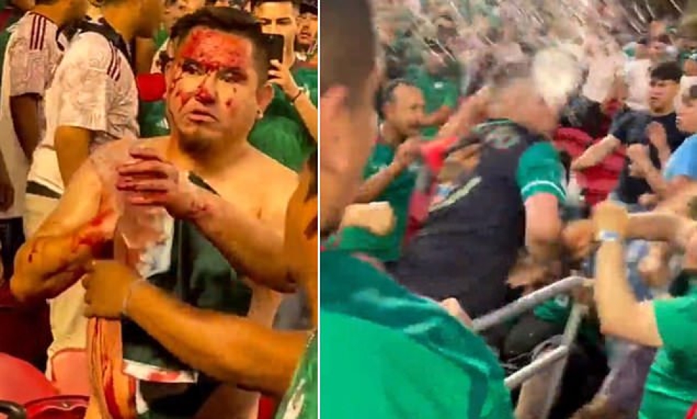 VIDEO: Một CĐV Mexico bị đâm trong trận tranh Gold Cup